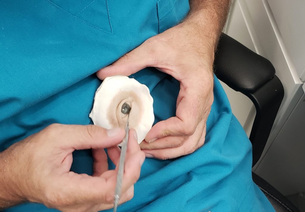 Prosthetic specialist working